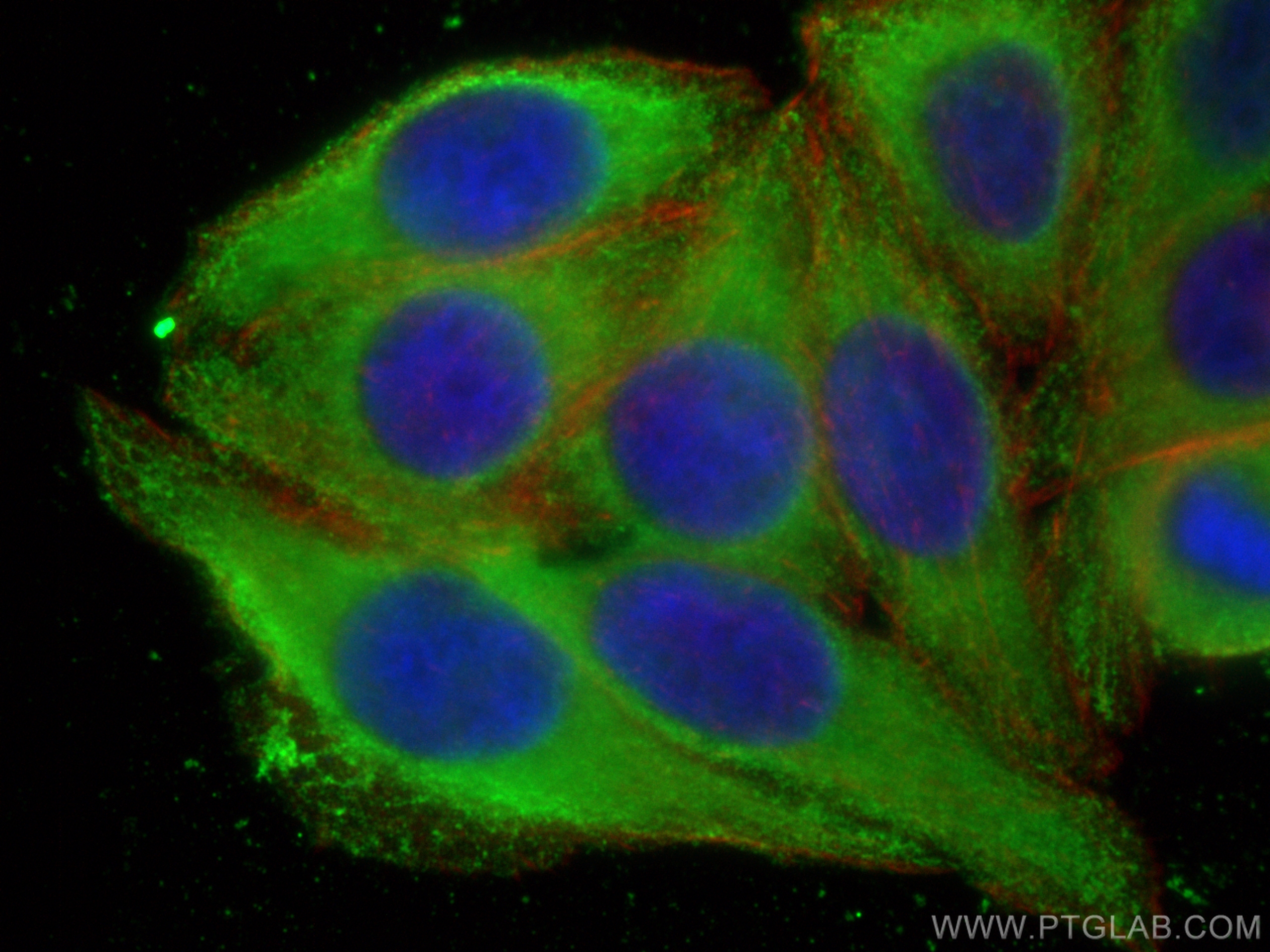 IF Staining of HepG2 using 67073-1-Ig (same clone as 67073-1-PBS)