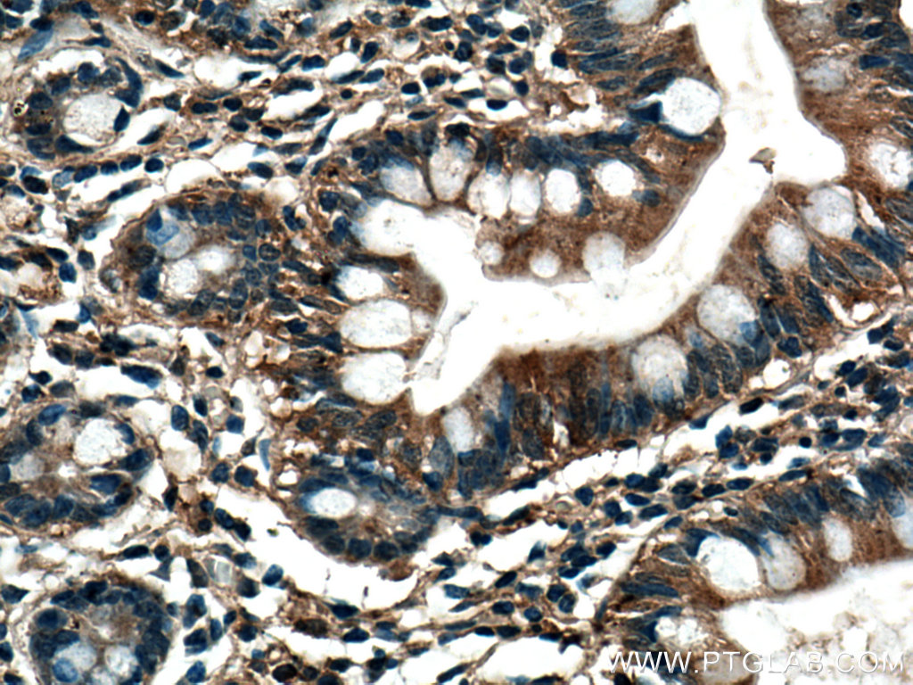IHC staining of human small intestine using 67073-1-Ig (same clone as 67073-1-PBS)