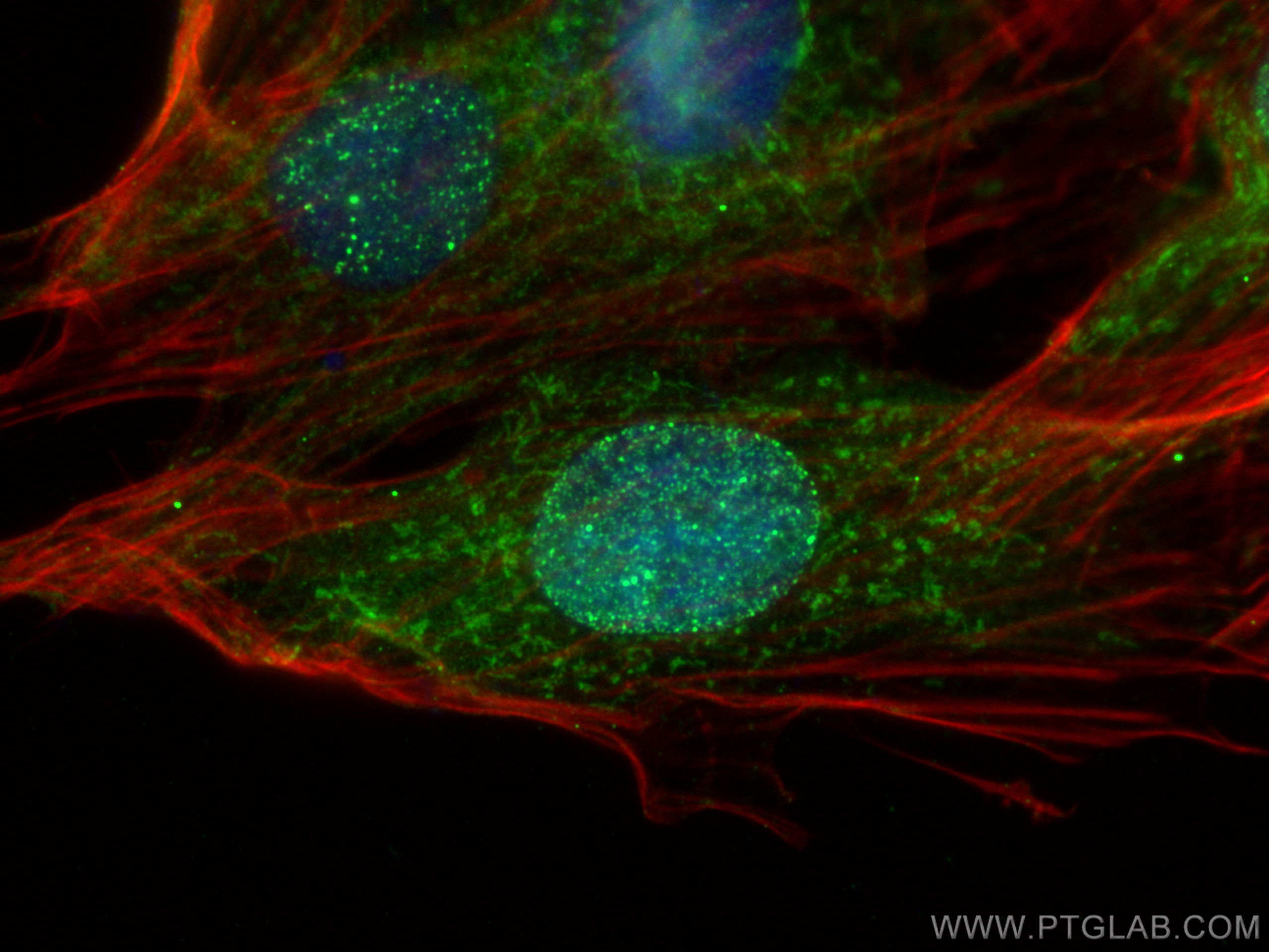 IF Staining of H9C2 using 18468-1-AP