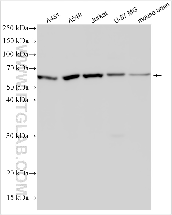 WB analysis using 31053-1-AP