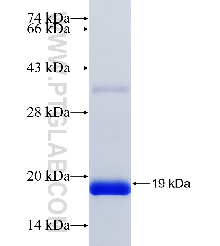 TRIM43 fusion protein Ag34920 SDS-PAGE TRIM43 fusion protein Ag34920 SDS-PAGE