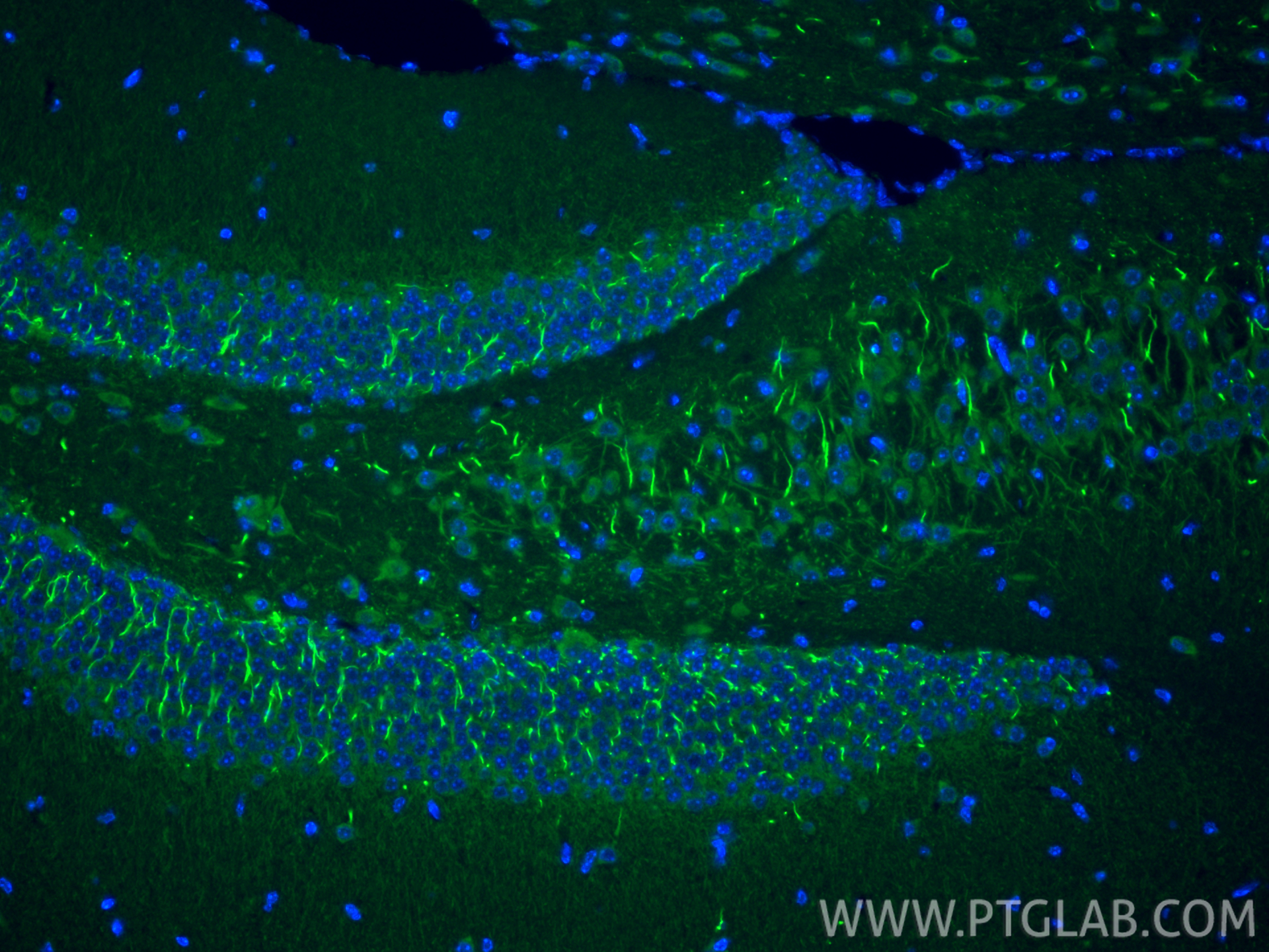 IF Staining of mouse brain using 21026-1-AP