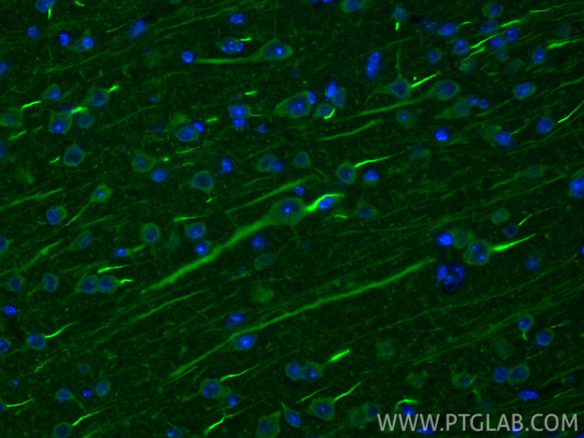 IF Staining of mouse brain using 21026-1-AP