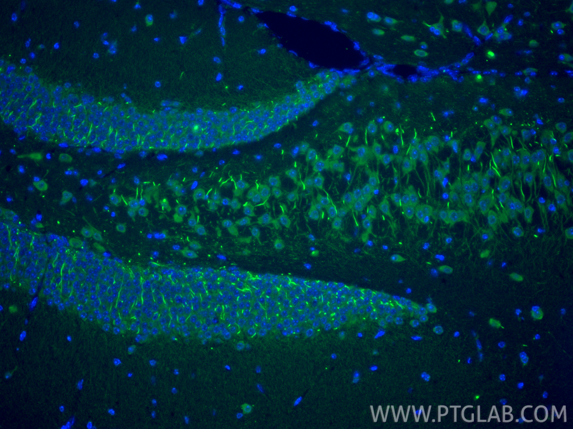 IF Staining of mouse brain using 30298-1-AP