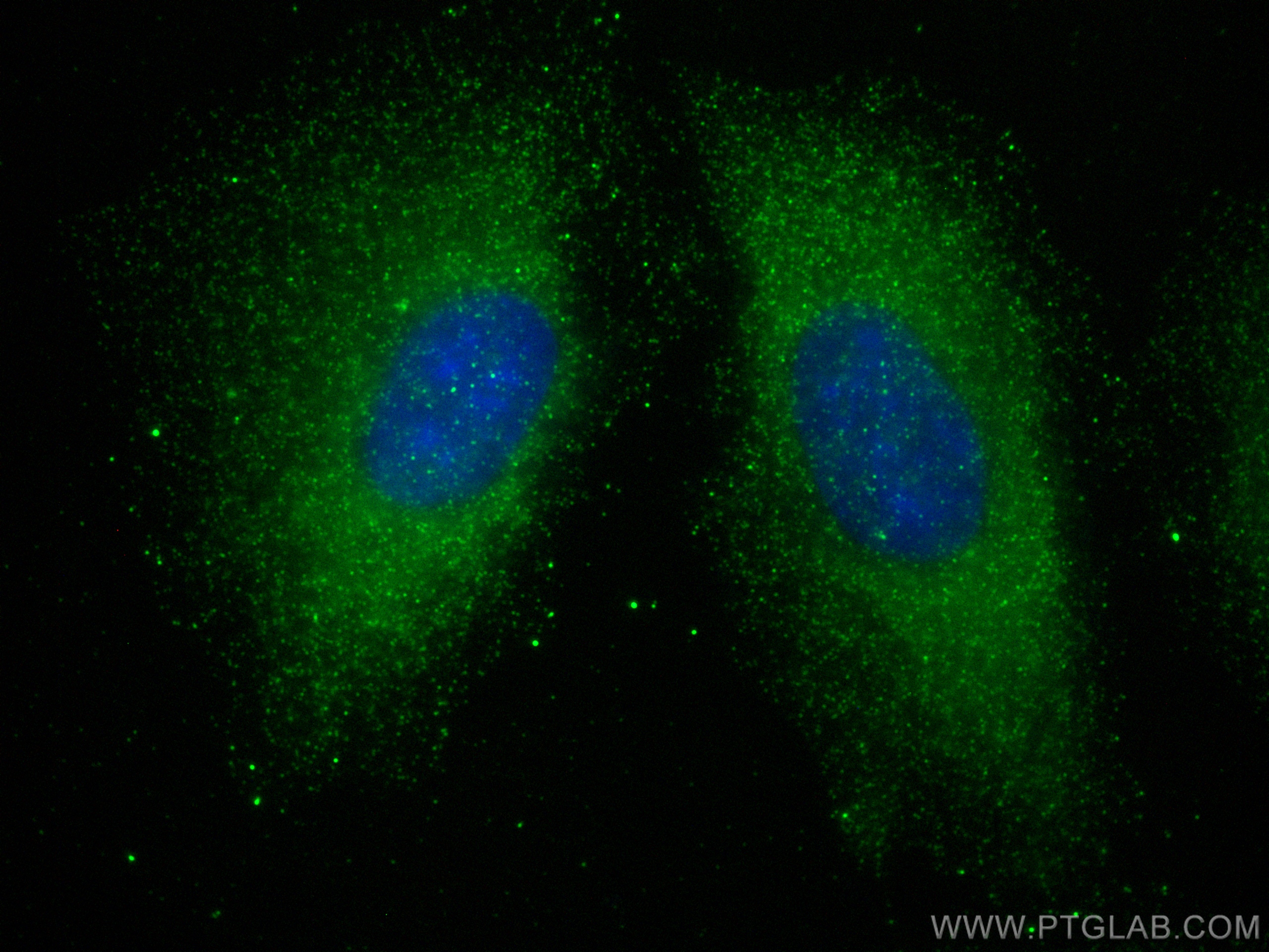 IF Staining of A549 using 83614-2-RR (same clone as 83614-2-PBS)