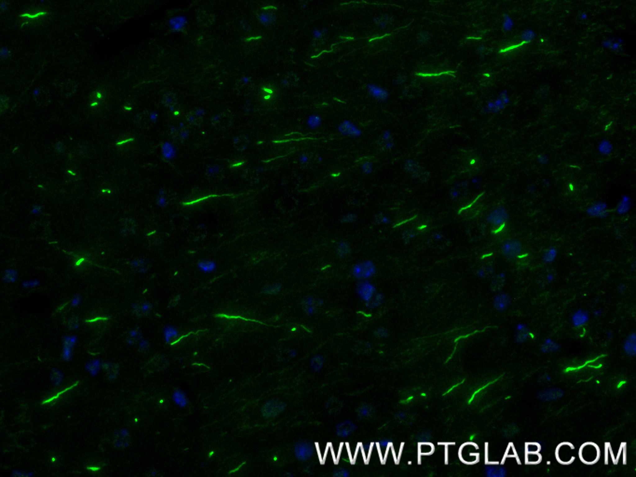 IF Staining of mouse brain using 83614-2-RR (same clone as 83614-2-PBS)