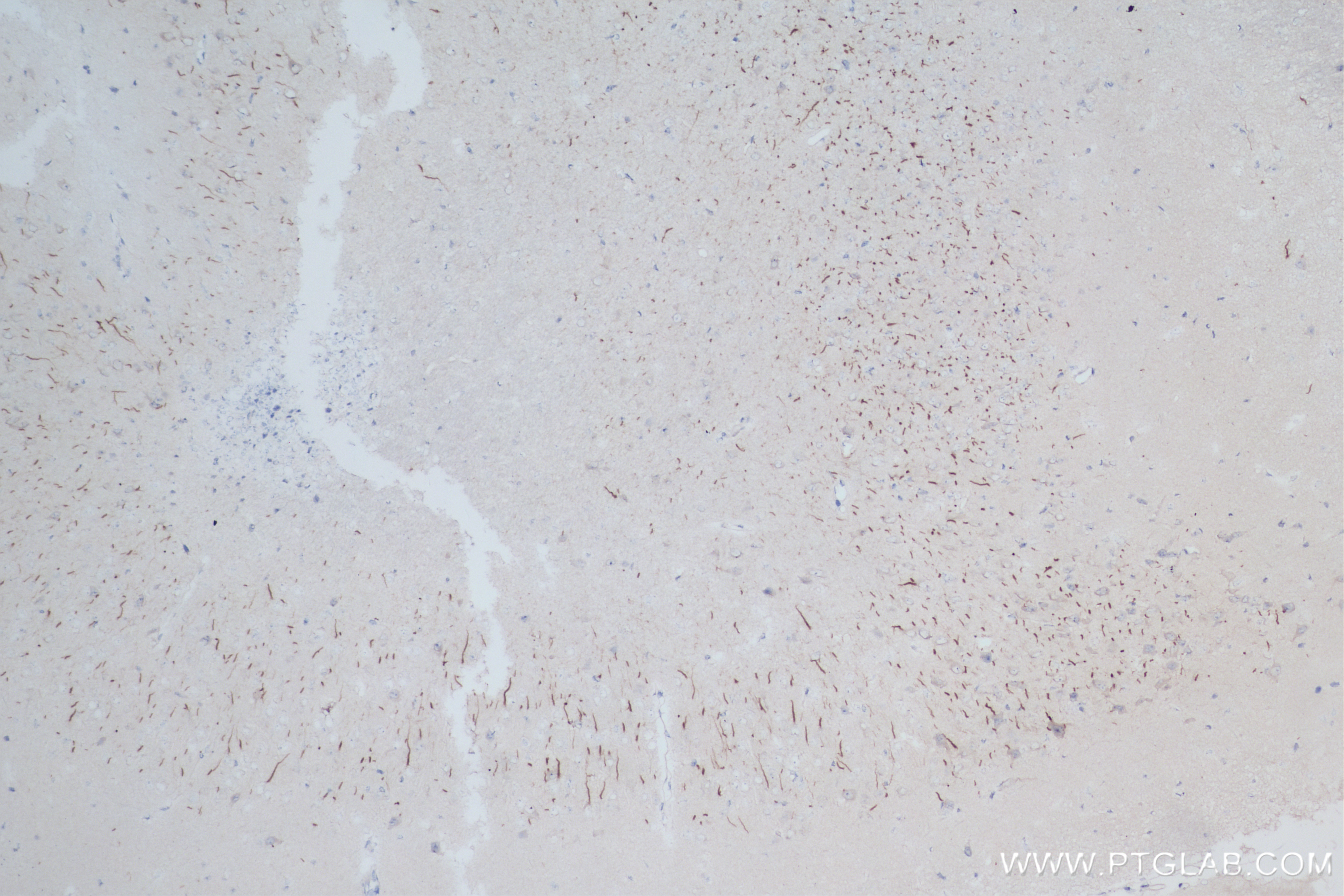 IHC staining of mouse brain using 83614-2-RR (same clone as 83614-2-PBS)
