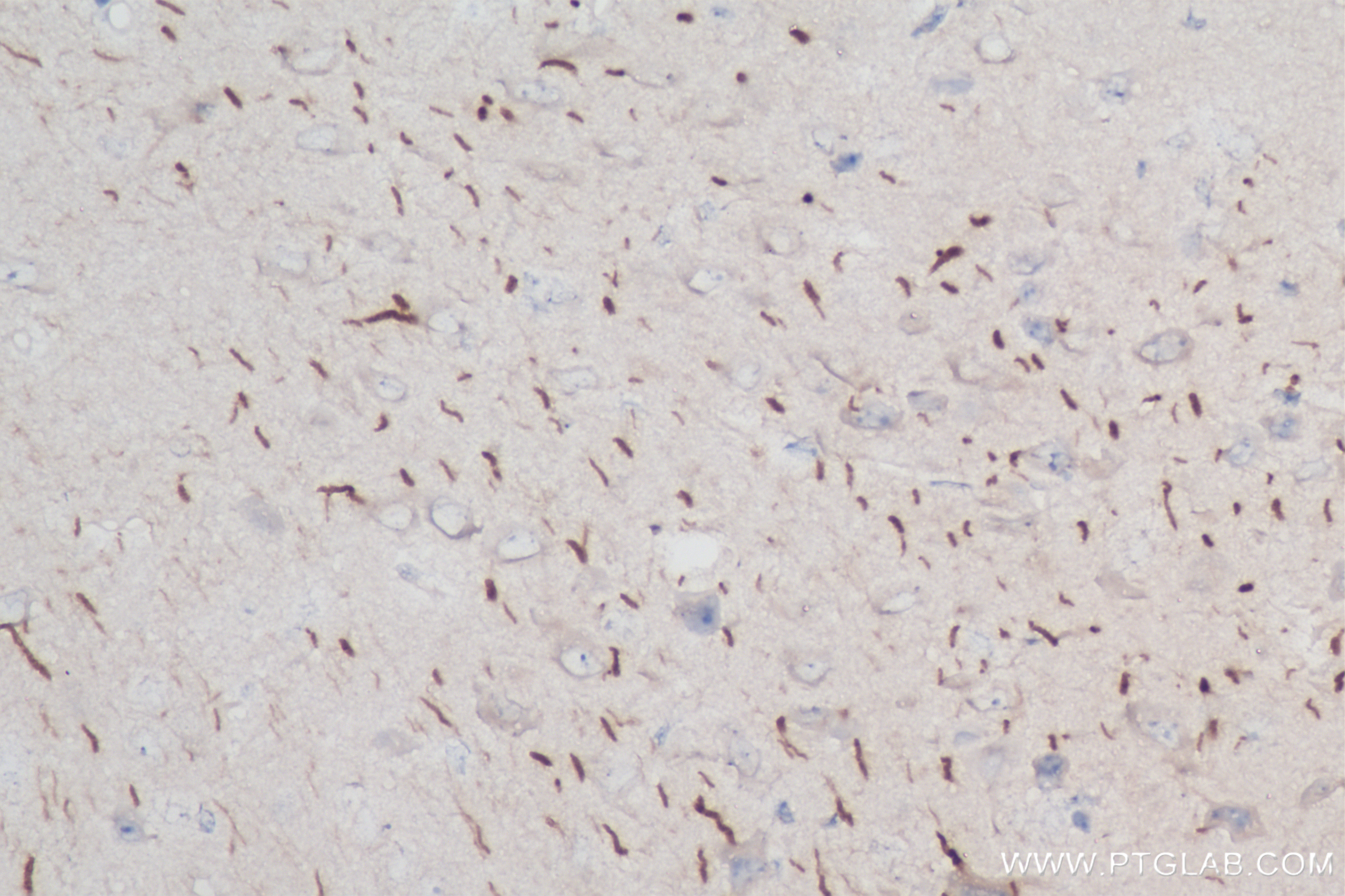 IHC staining of mouse brain using 83614-2-RR (same clone as 83614-2-PBS)