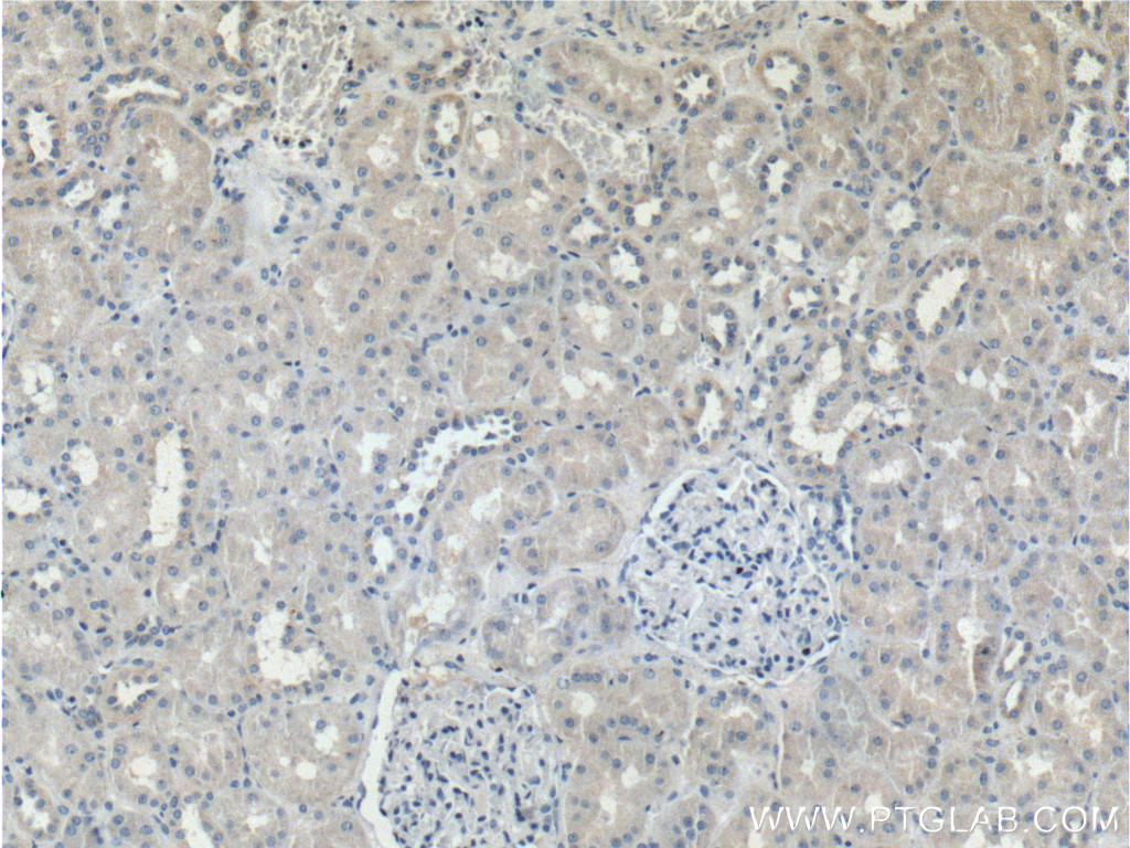 IHC staining of human kidney using 26885-1-AP