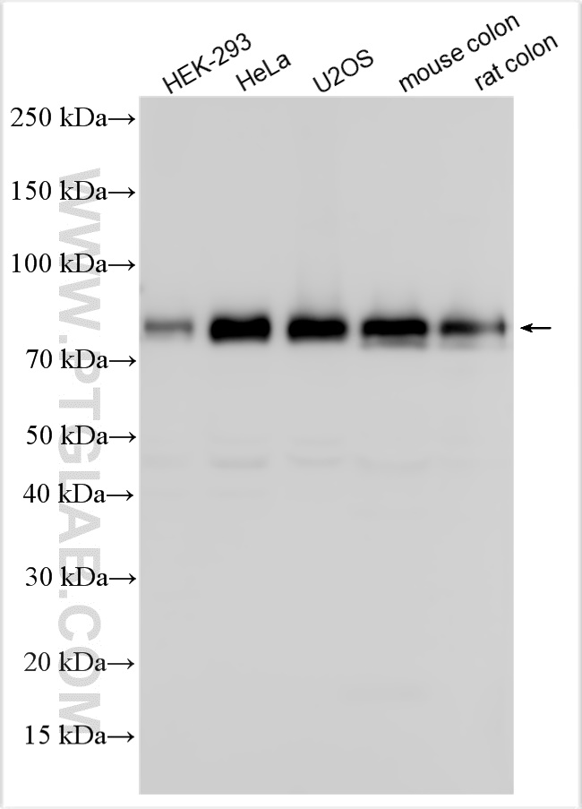 Various lysates were subjected to SDS PAGE followed by western blot with 26885-1-AP (TRIM47 antibody) at dilution of 1:3000 incubated at room temperature for 1.5 hours. WB analysis using 26885-1-AP