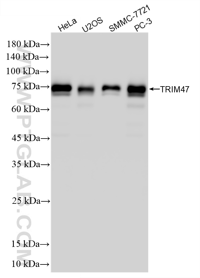 WB analysis using 86728-1-RR (same clone as 86728-1-PBS) WB analysis using 86728-1-RR (same clone as 86728-1-PBS)