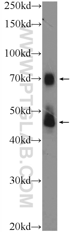 TRIM5 Polyclonal antibody