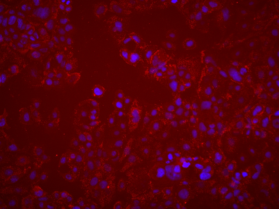 IF Staining of HT-1376 using 67492-1-Ig (same clone as 67492-1-PBS) IF Staining of HT-1376 using 67492-1-Ig (same clone as 67492-1-PBS)