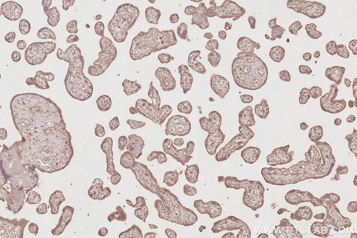 IHC staining of human placenta using 67492-1-Ig IHC staining of human placenta using 67492-1-Ig