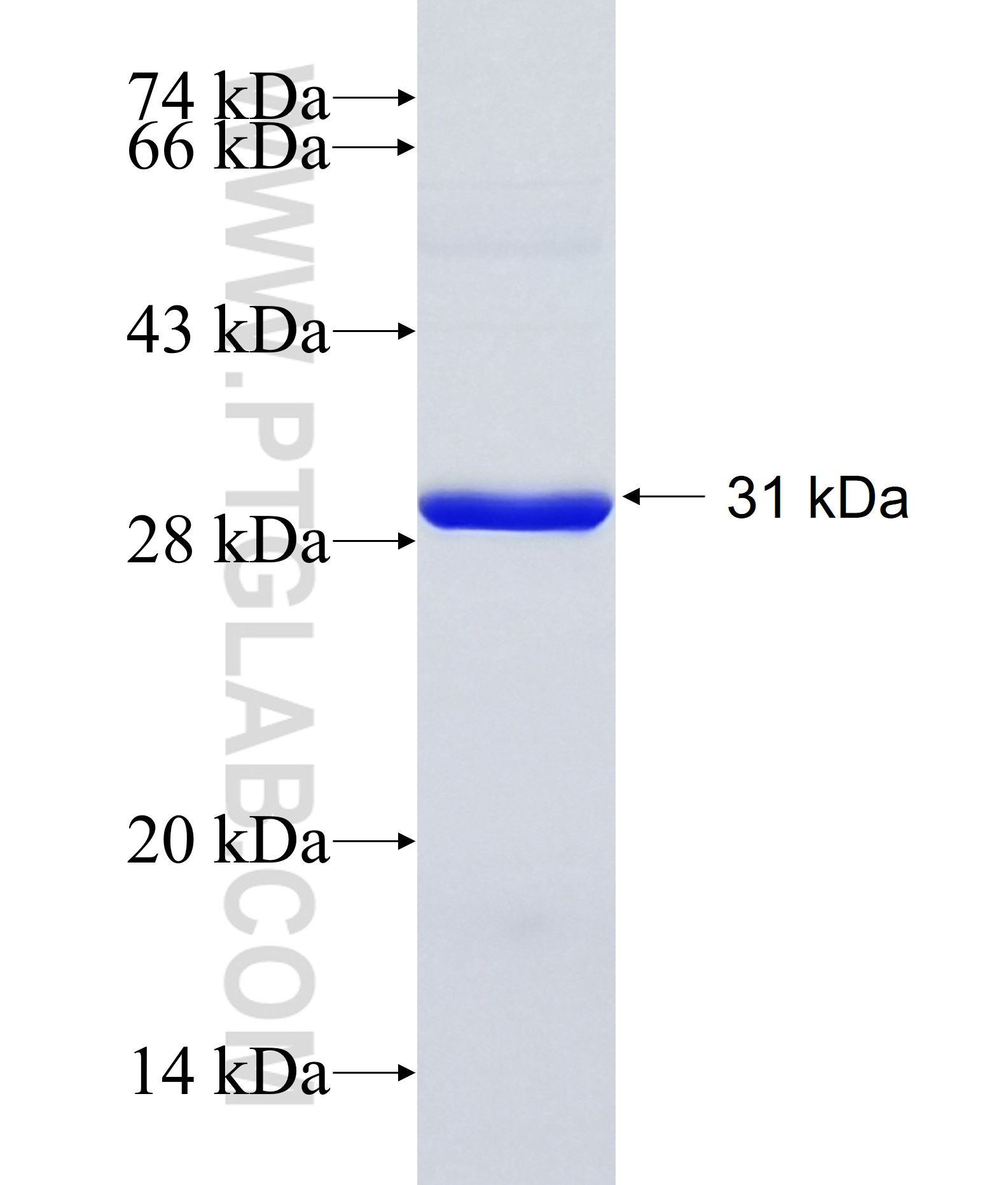 TRIM50 fusion protein Ag34609 SDS-PAGE