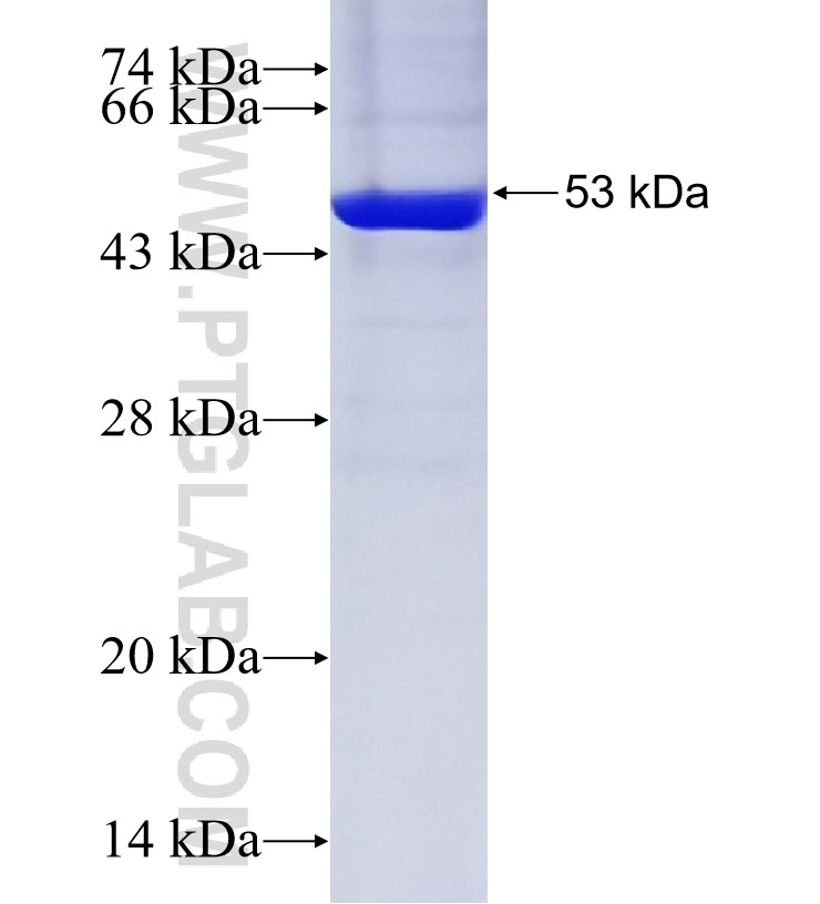 TRIM50 fusion protein Ag34637 SDS-PAGE