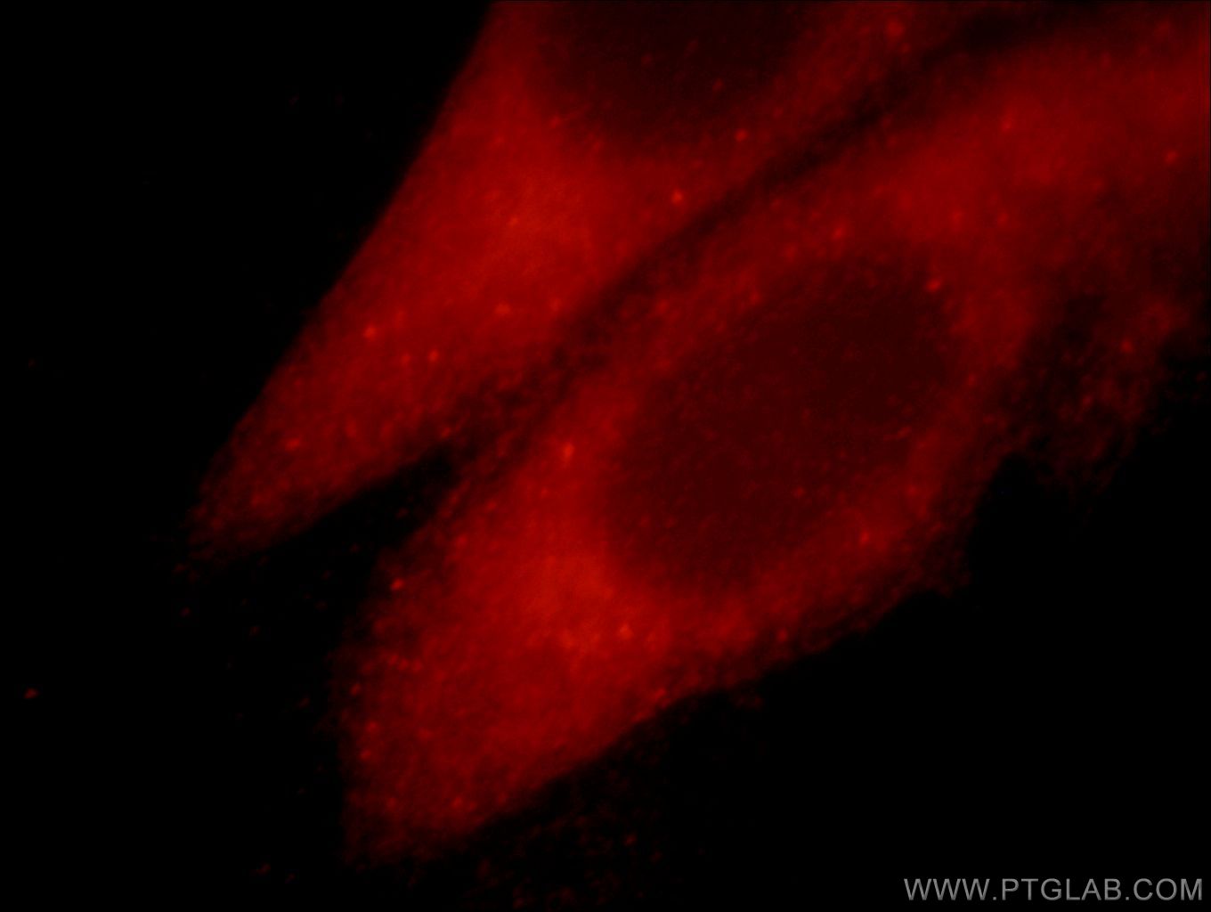 IF Staining of HepG2 using 21074-1-AP