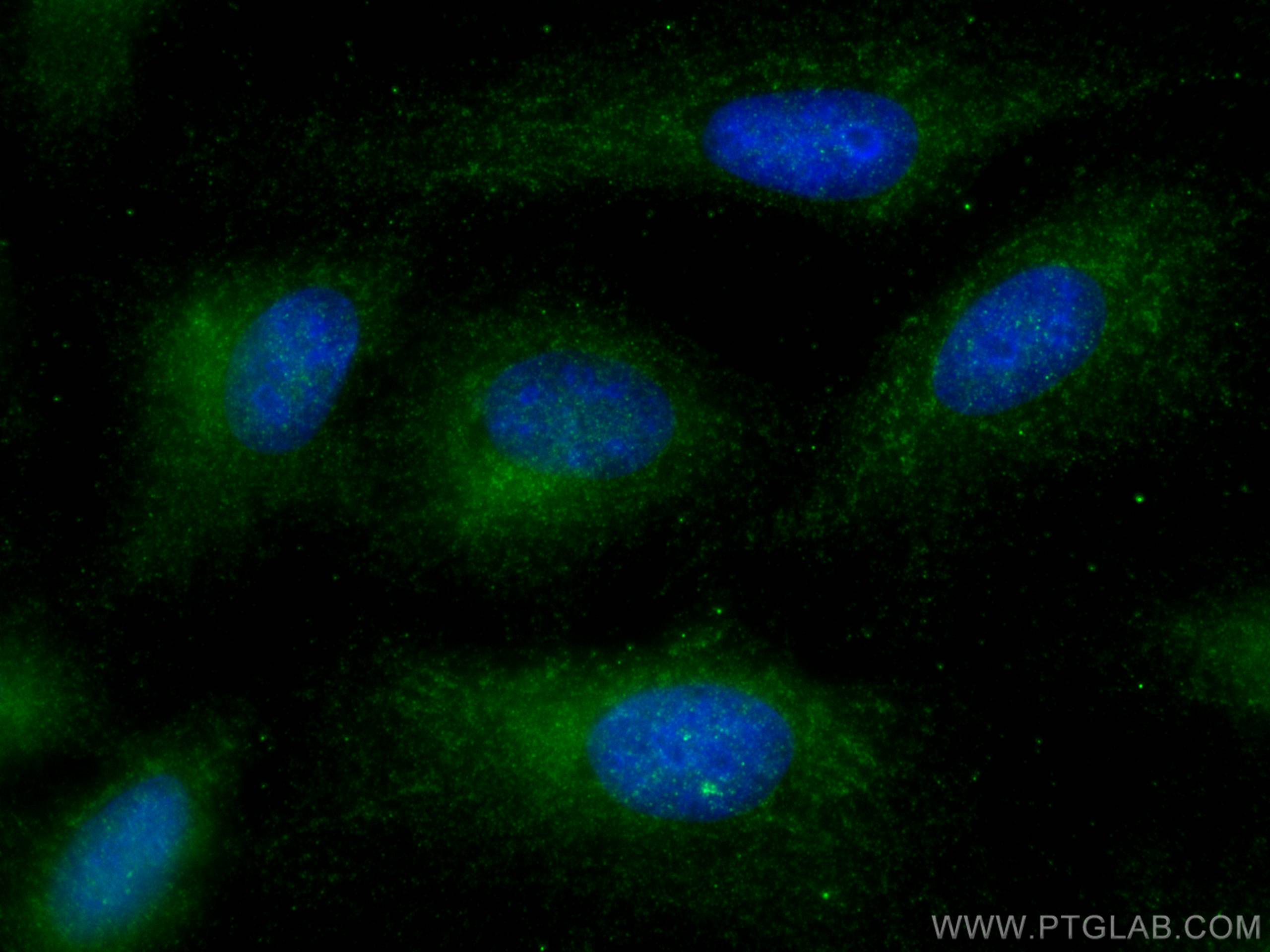 IF Staining of U2OS using 28575-1-AP