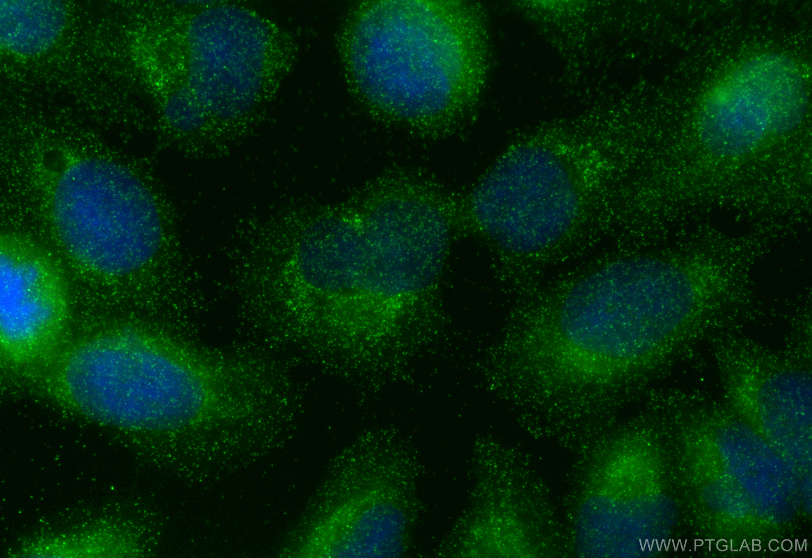 IF Staining of U2OS using 24371-1-AP