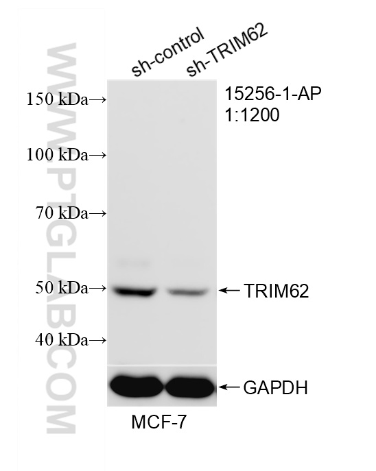 WB analysis of MCF-7 using 15256-1-AP