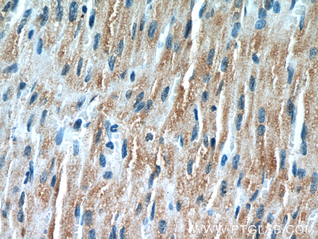 IHC staining of human heart using 55456-1-AP