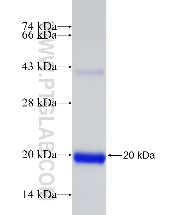 TRIM66 fusion protein Ag30404 SDS-PAGE TRIM66 fusion protein Ag30404 SDS-PAGE