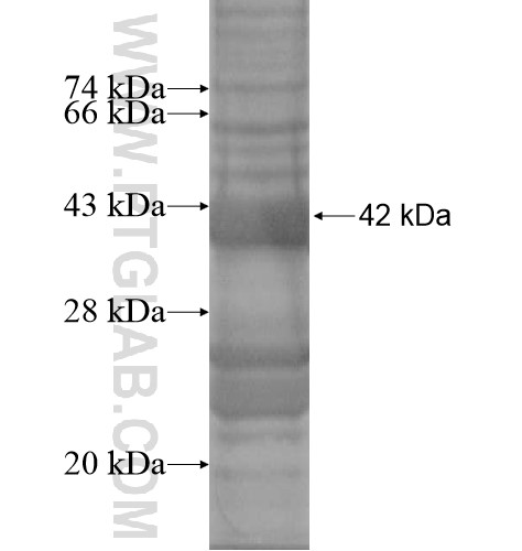TRIM69 fusion protein Ag14449 SDS-PAGE TRIM69 fusion protein Ag14449 SDS-PAGE
