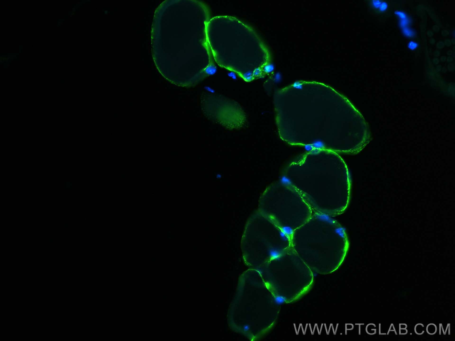 IF Staining of mouse skeletal muscle using 22151-1-AP