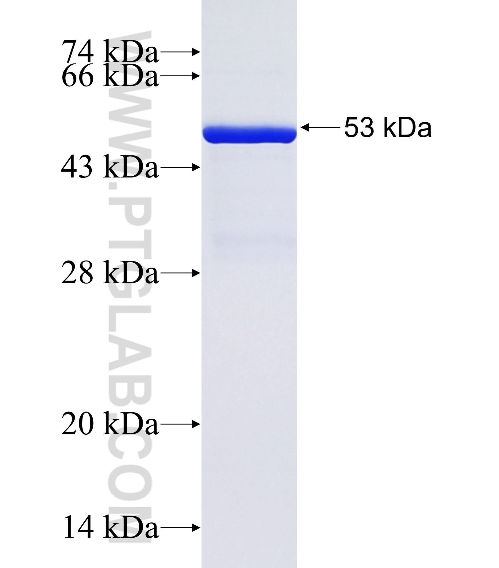TRIM74 fusion protein Ag37111 SDS-PAGE TRIM74 fusion protein Ag37111 SDS-PAGE