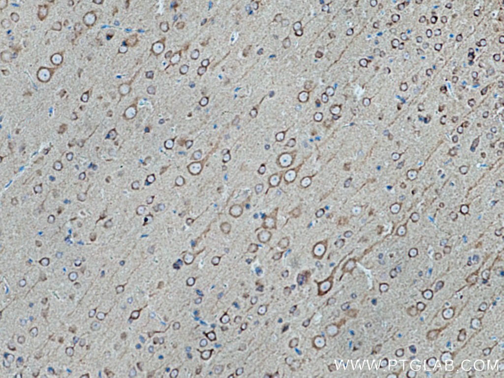 IHC staining of rat brain using 10786-1-AP