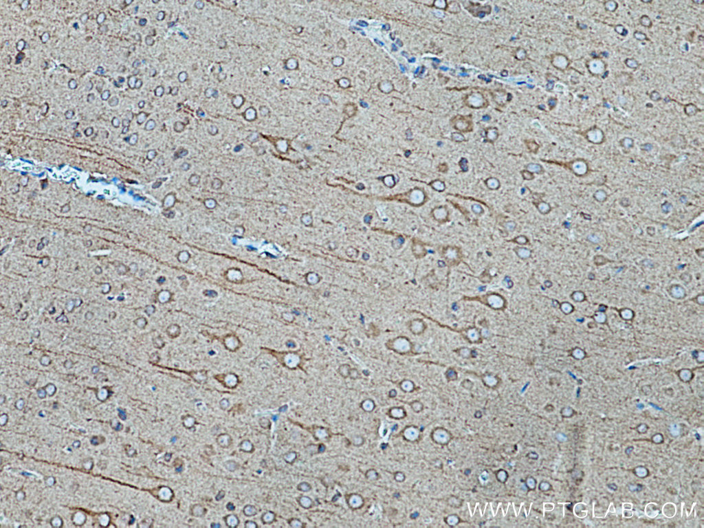 IHC staining of rat brain using 67268-1-Ig (same clone as 67268-1-PBS)