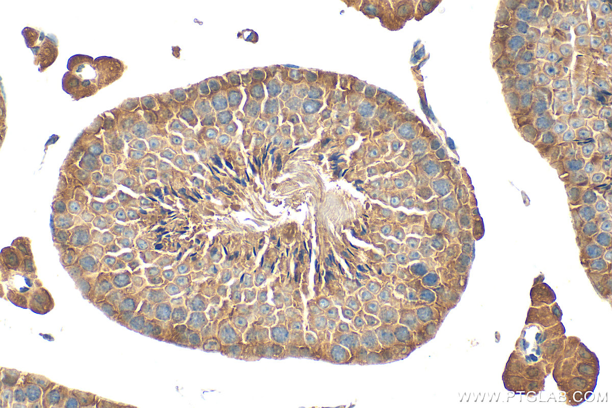 IHC staining of mouse testis using 31976-1-AP