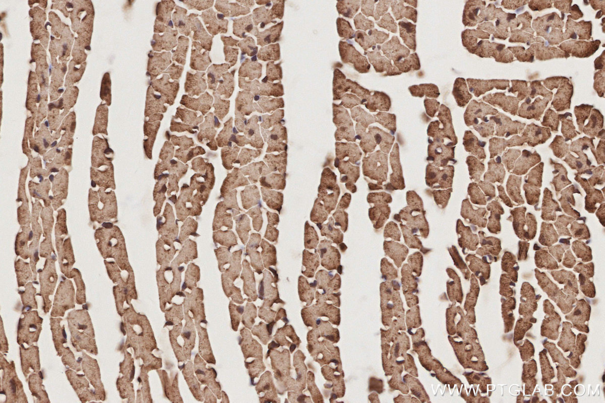 IHC staining of mouse heart using 16124-1-AP