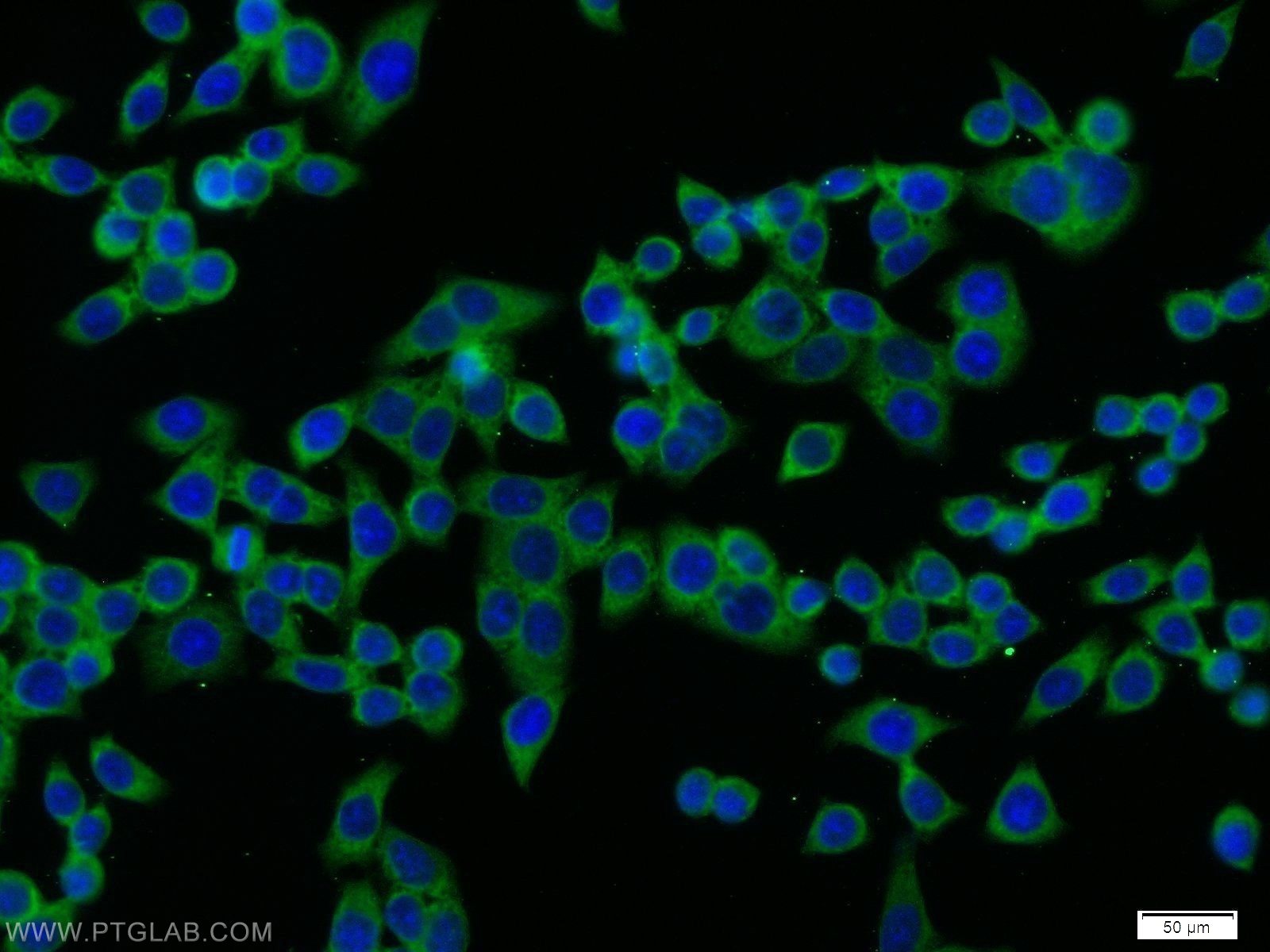 IF Staining of BxPC-3 using 10798-1-AP