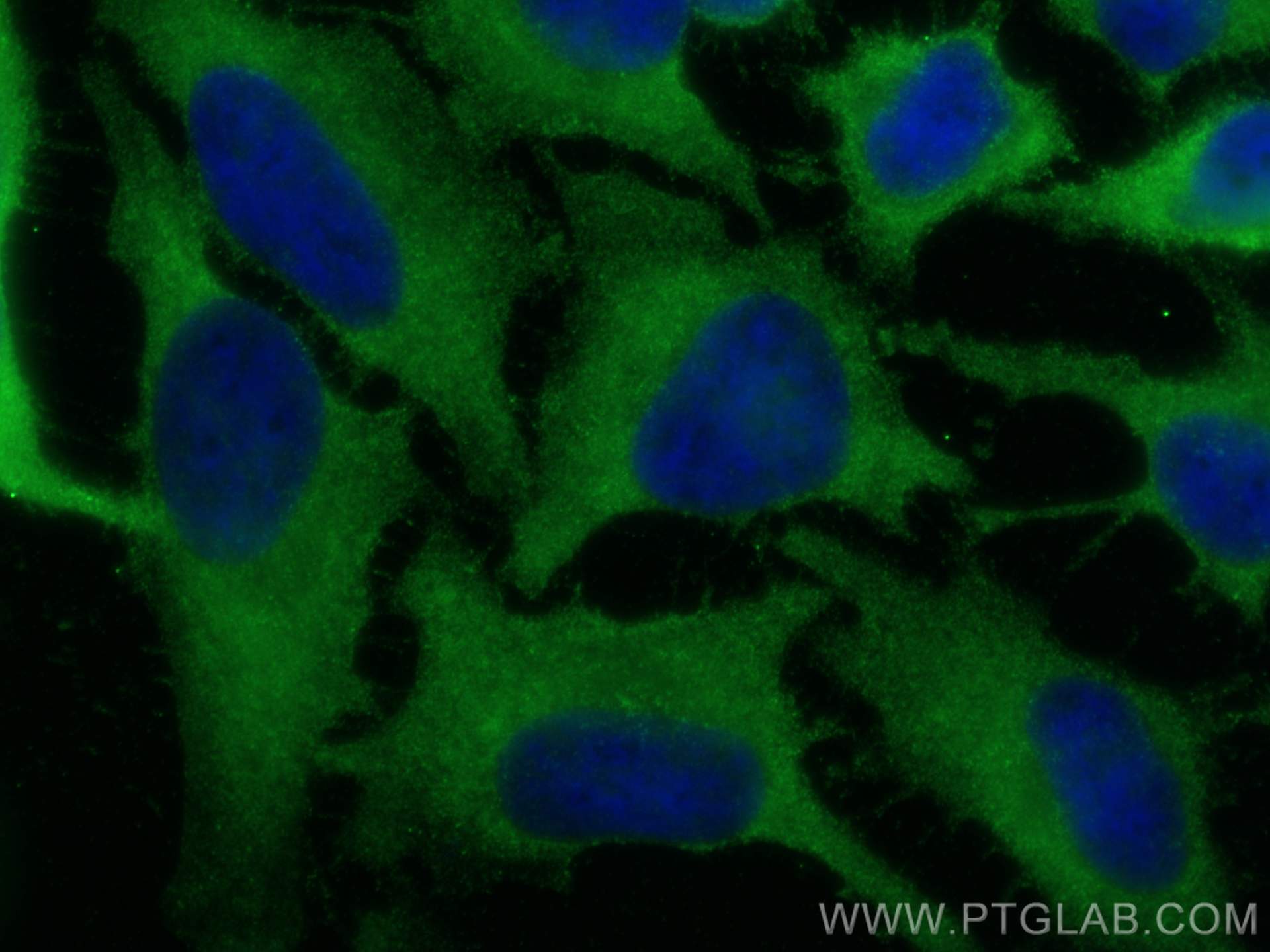 IF Staining of HeLa using 10798-1-AP