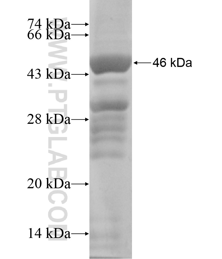 TRIP12 fusion protein Ag18155 SDS-PAGE TRIP12 fusion protein Ag18155 SDS-PAGE