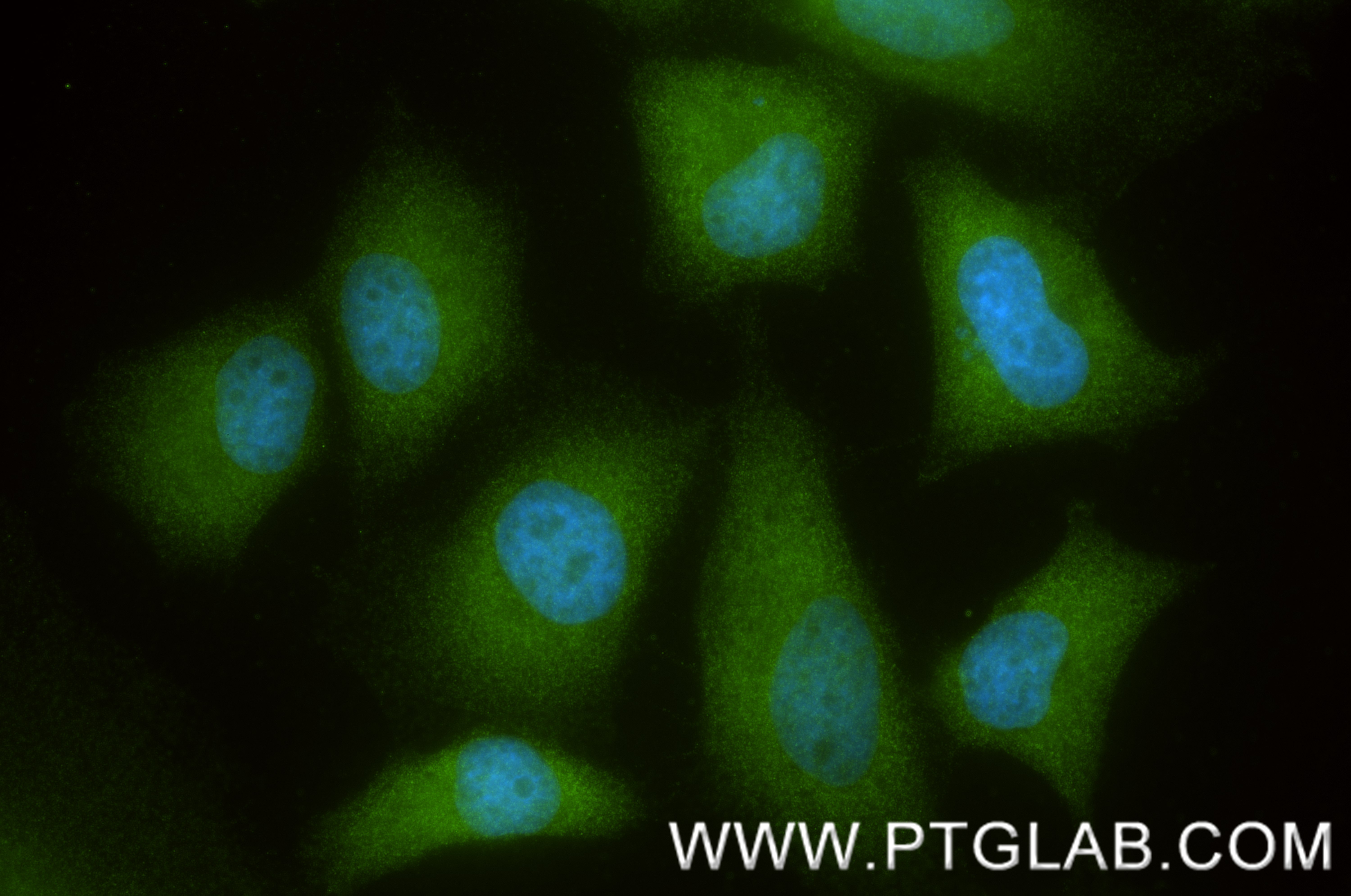 IF Staining of HeLa using 88025-1-RR