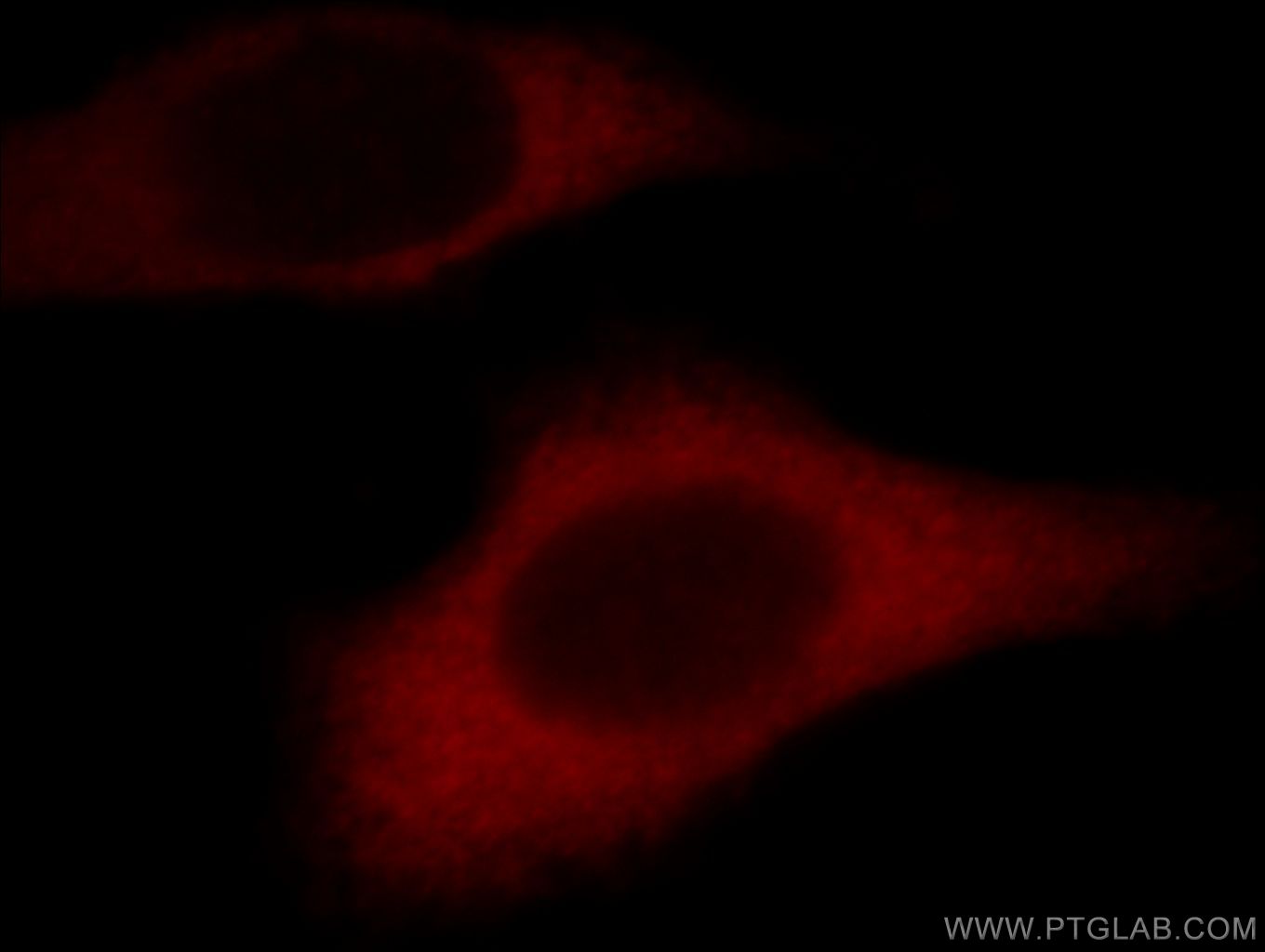 IF Staining of HepG2 using 21163-1-AP