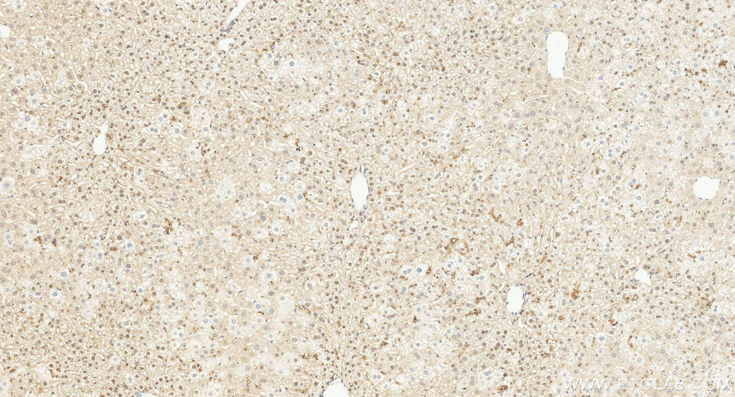 IHC staining of mouse liver using 21163-1-AP IHC staining of mouse liver using 21163-1-AP