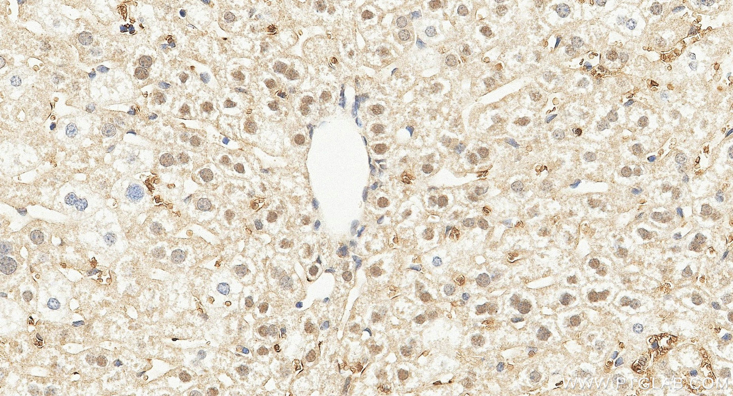 IHC staining of mouse liver using 21163-1-AP IHC staining of mouse liver using 21163-1-AP