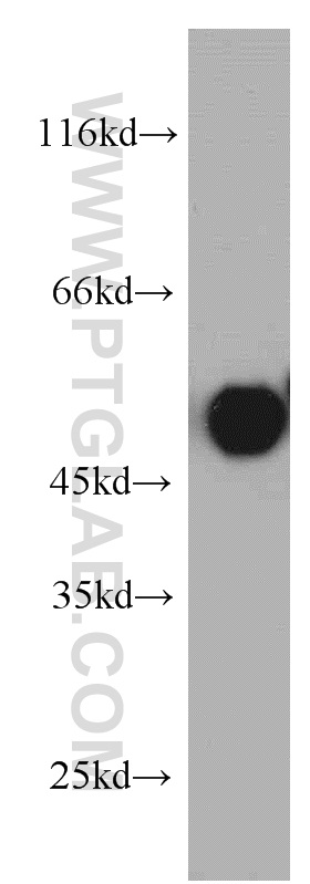 WB analysis of HeLa using 21163-1-AP