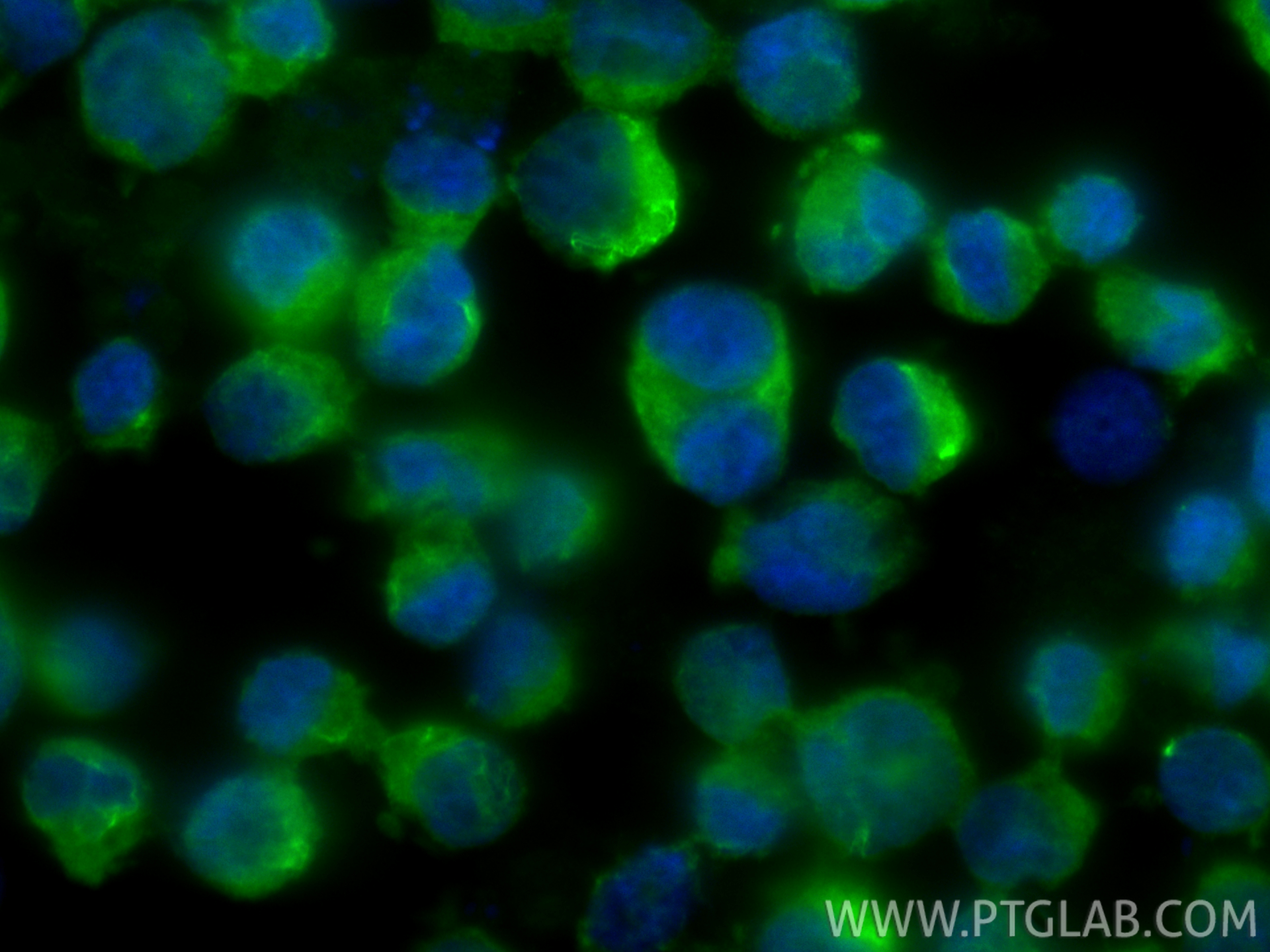 IF Staining of K-562 using 17141-1-AP IF Staining of K-562 using 17141-1-AP