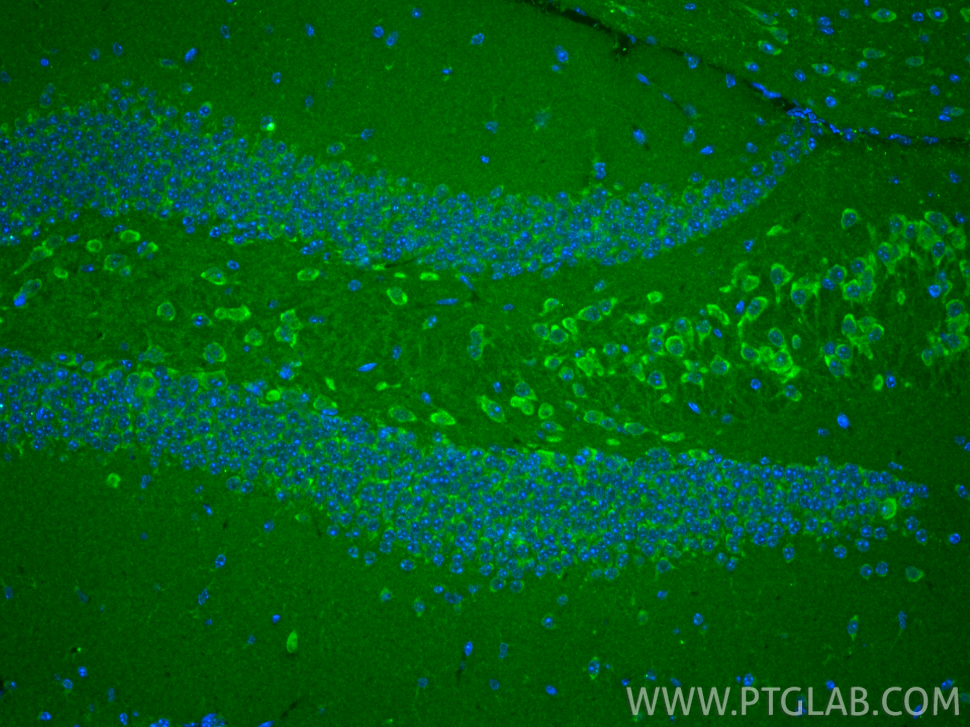 IF Staining of mouse brain using 17141-1-AP IF Staining of mouse brain using 17141-1-AP