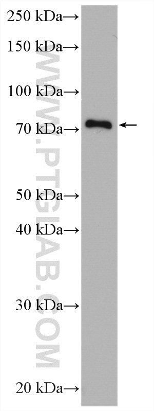 WB analysis of HeLa using 14970-1-AP