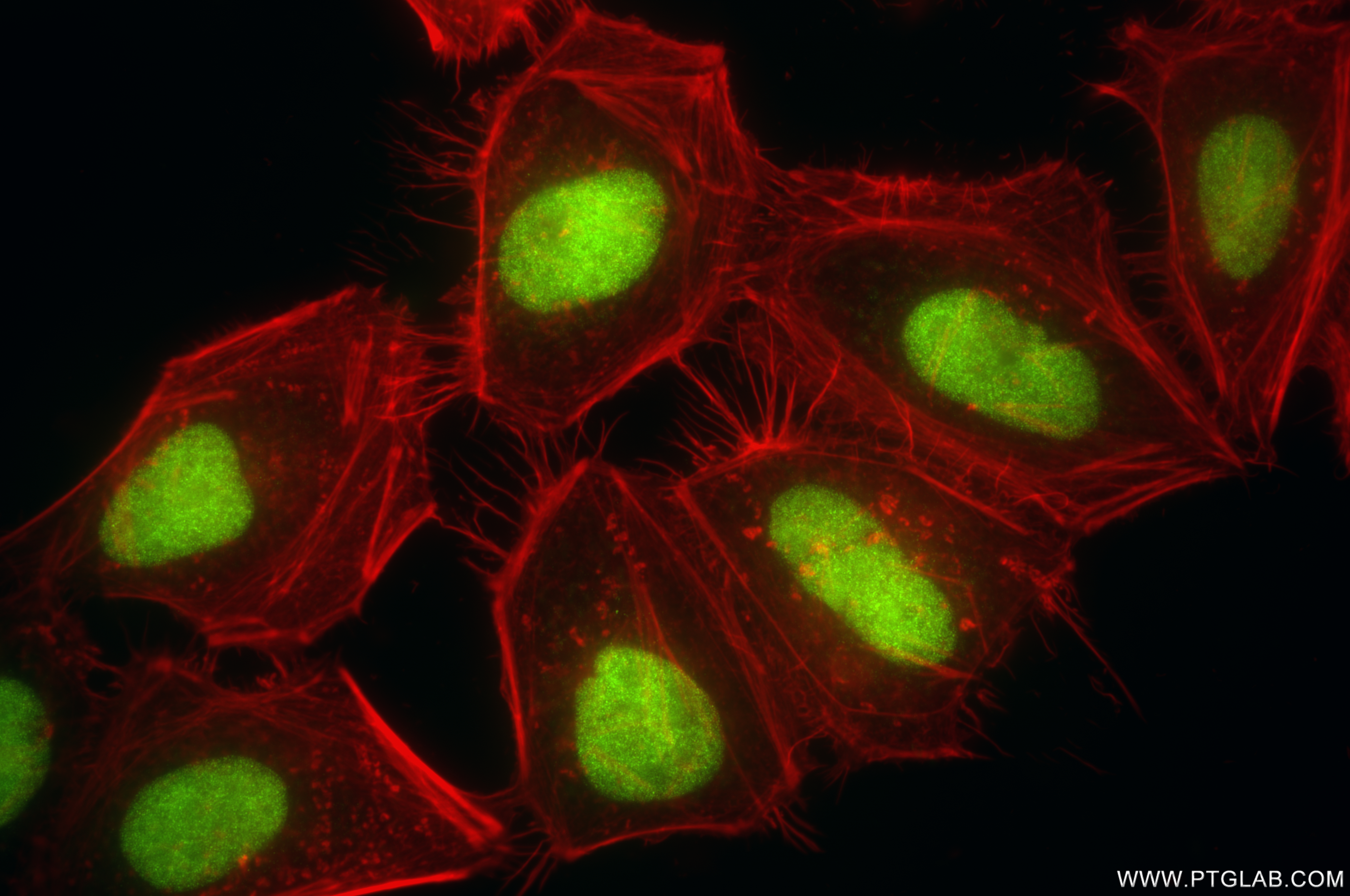 IF Staining of HeLa using 85897-5-RR