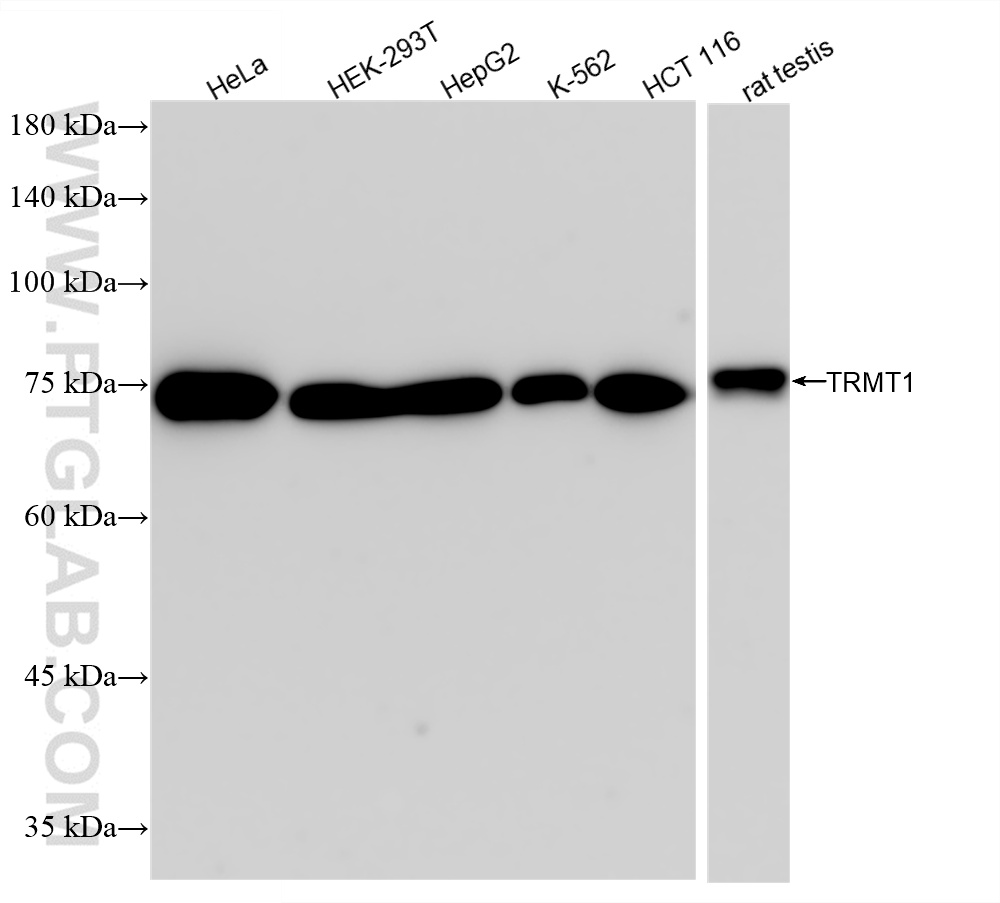 WB analysis using 85897-5-RR
