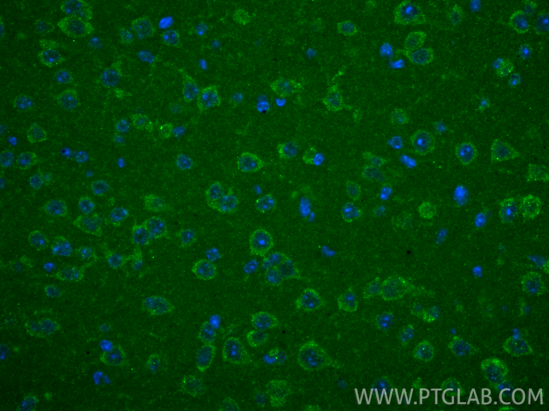 IF Staining of mouse brain using 84991-4-RR IF Staining of mouse brain using 84991-4-RR