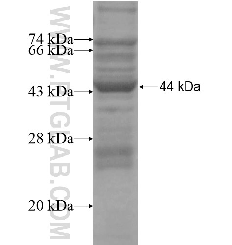 TRMT2B fusion protein Ag14750 SDS-PAGE