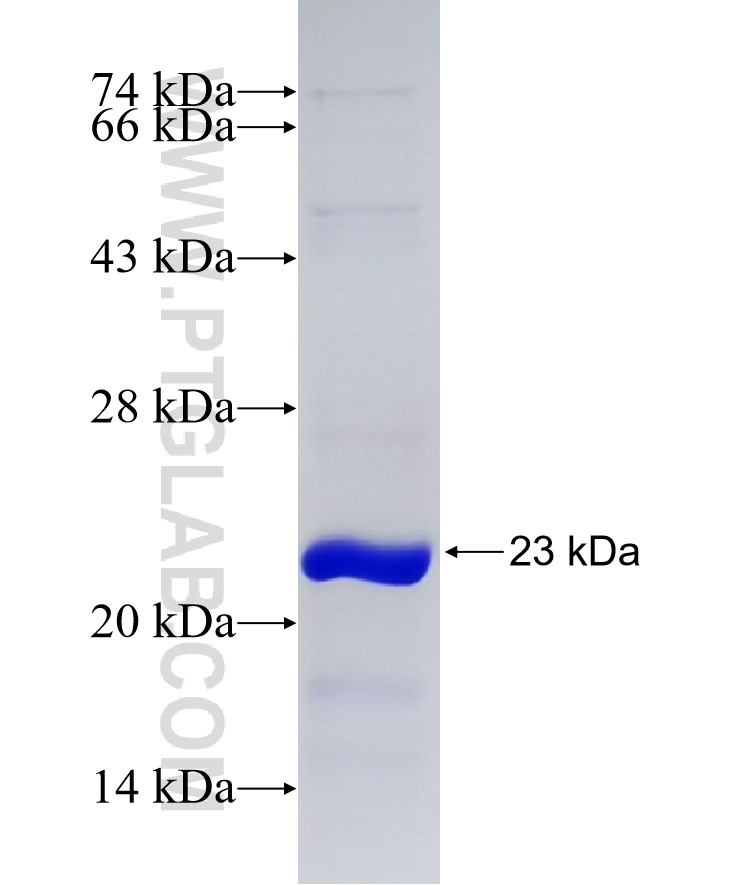 TRMT2B fusion protein Ag14969 SDS-PAGE TRMT2B fusion protein Ag14969 SDS-PAGE