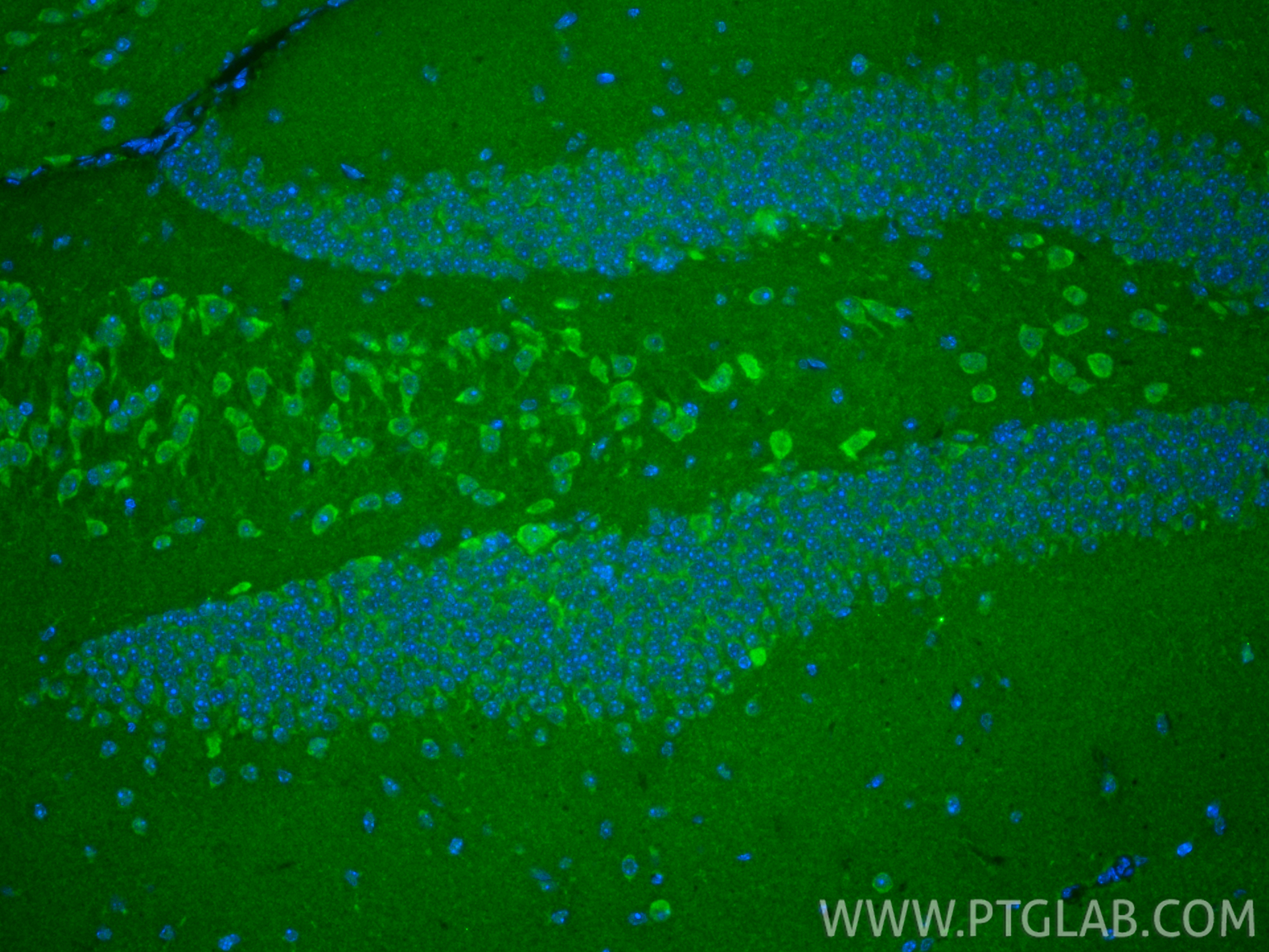 IF Staining of mouse brain using 18255-1-AP